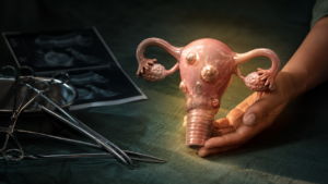 A woman’s hands protecting a uterus with fibroids beside surgical