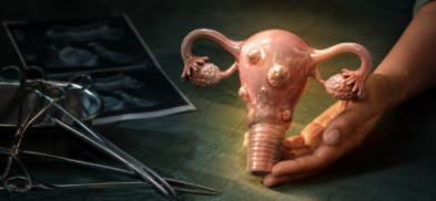 A woman’s hands protecting a uterus with fibroids beside surgical