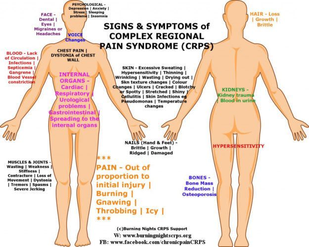 CRPS-Symptoms-CRPS-Signs-RSD-Signs-RSD-Symptoms